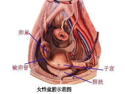 盆腔炎的症状有哪些，如何预防盆腔炎，盆腔炎的症状，盆腔炎有什么症状